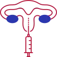 Indira IVF In Vitro Fertilization