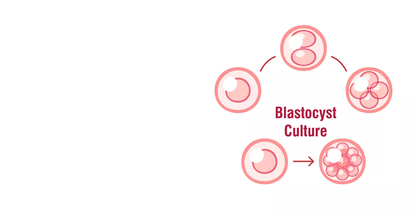 Blastocyst culture and transfer