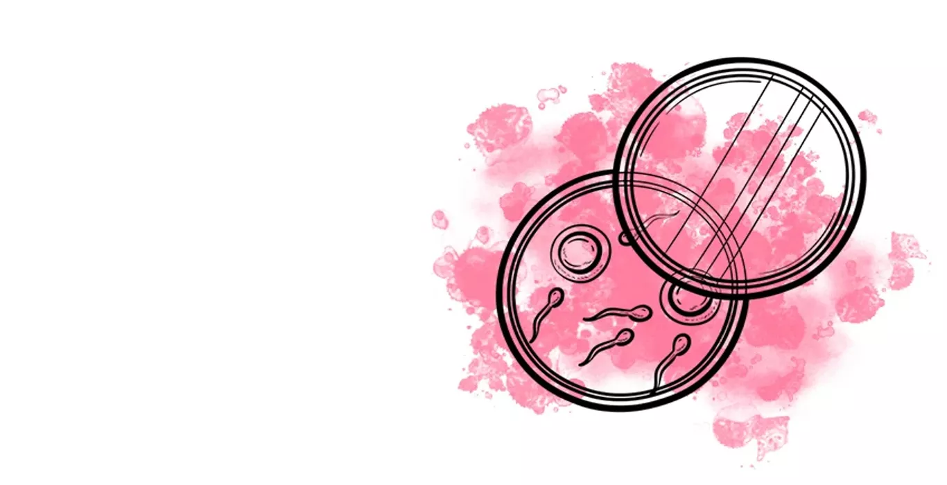 Laser assisted hatching