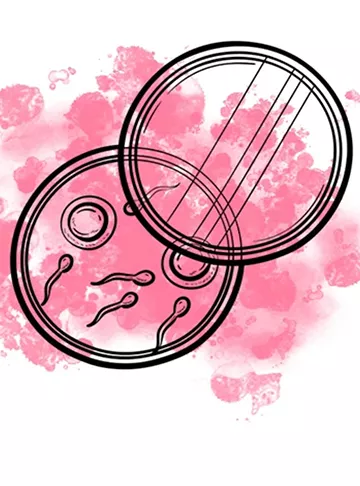 Laser assisted hatching